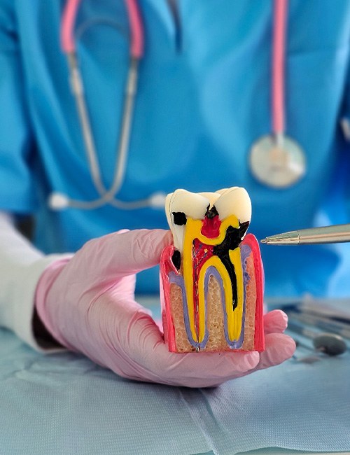 A dentist holding a model of a tooth