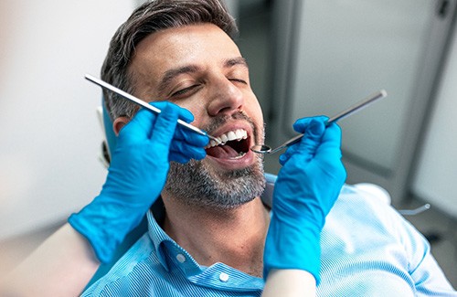 Man with salt and pepper hair and facial hair with eyes closed for dental exam