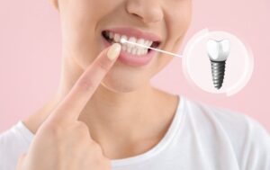 Woman smiling with a dental implant