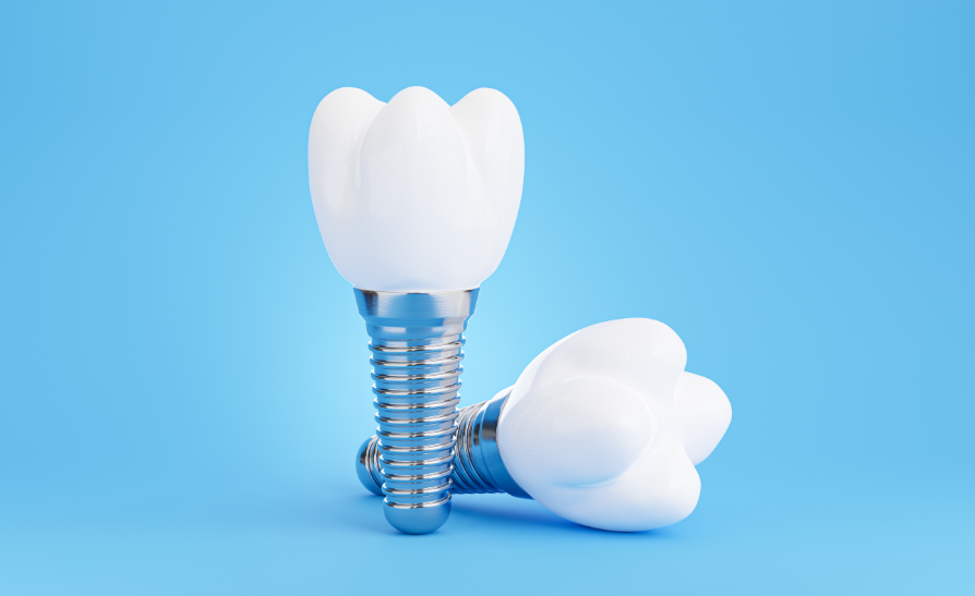 3D dental implants